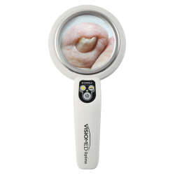 Visomed  Optima undersgelseslampe