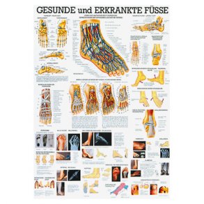 Plakat af fod og fejlstillinger