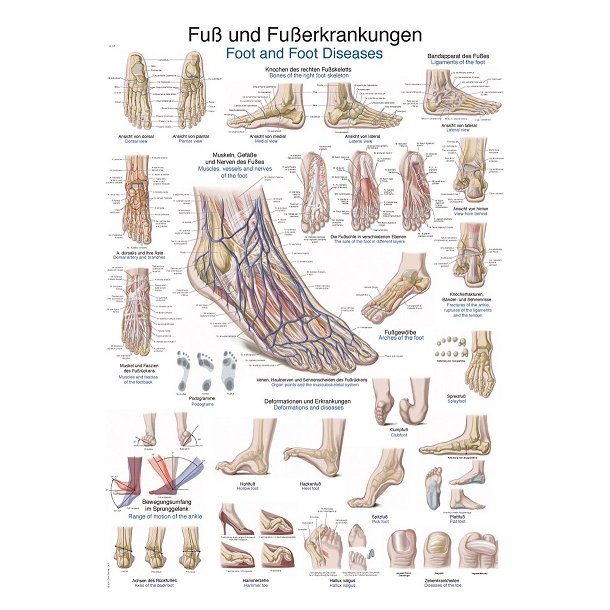Plakat af fod og fodsygdomme 50x70 cm